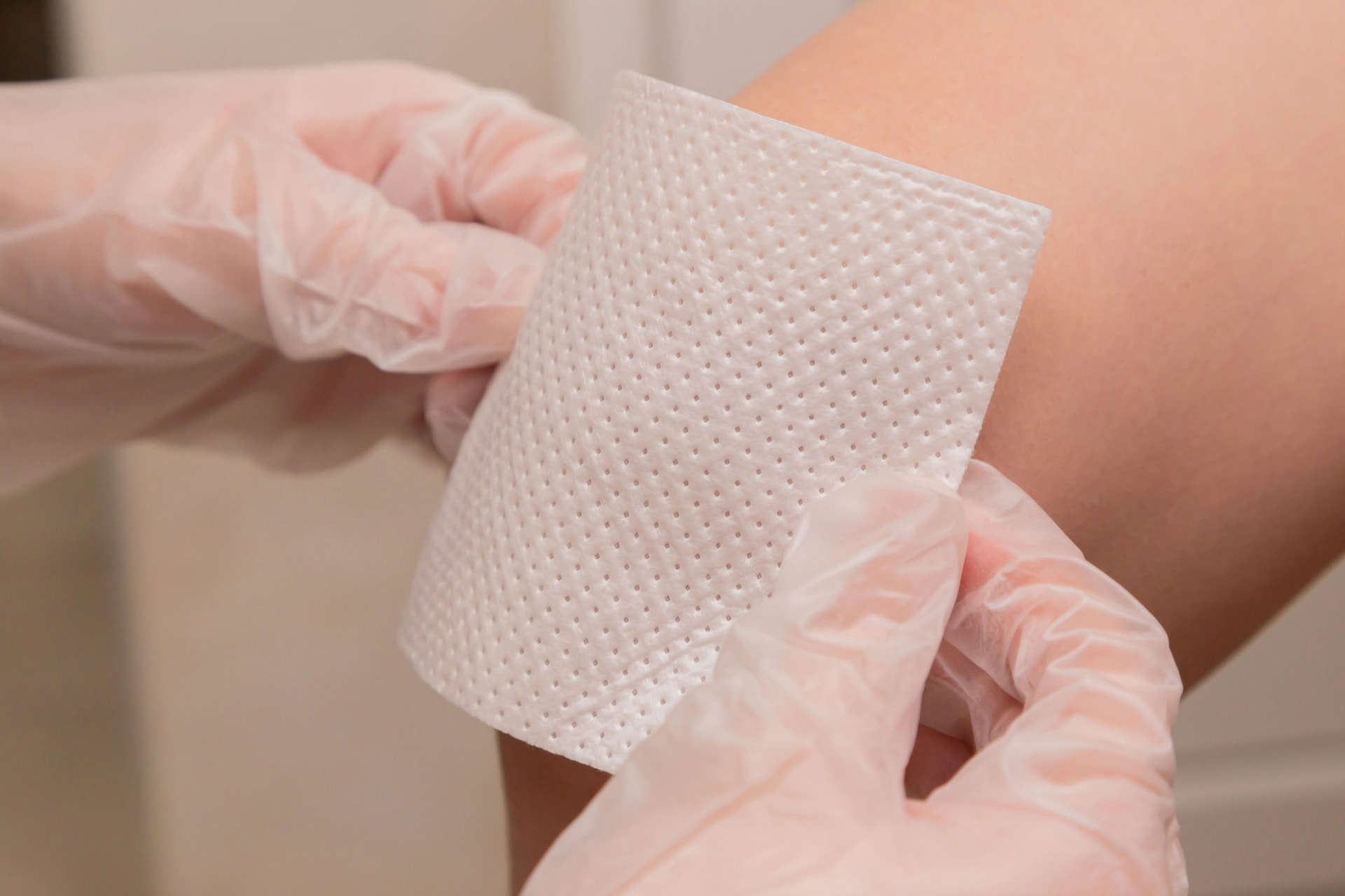 Clinician applying a wound care dressing